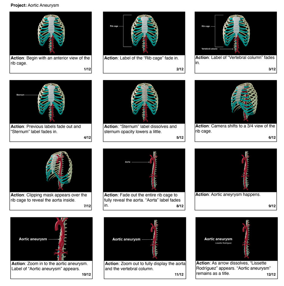 Aortic Aneurysm – Storyboards